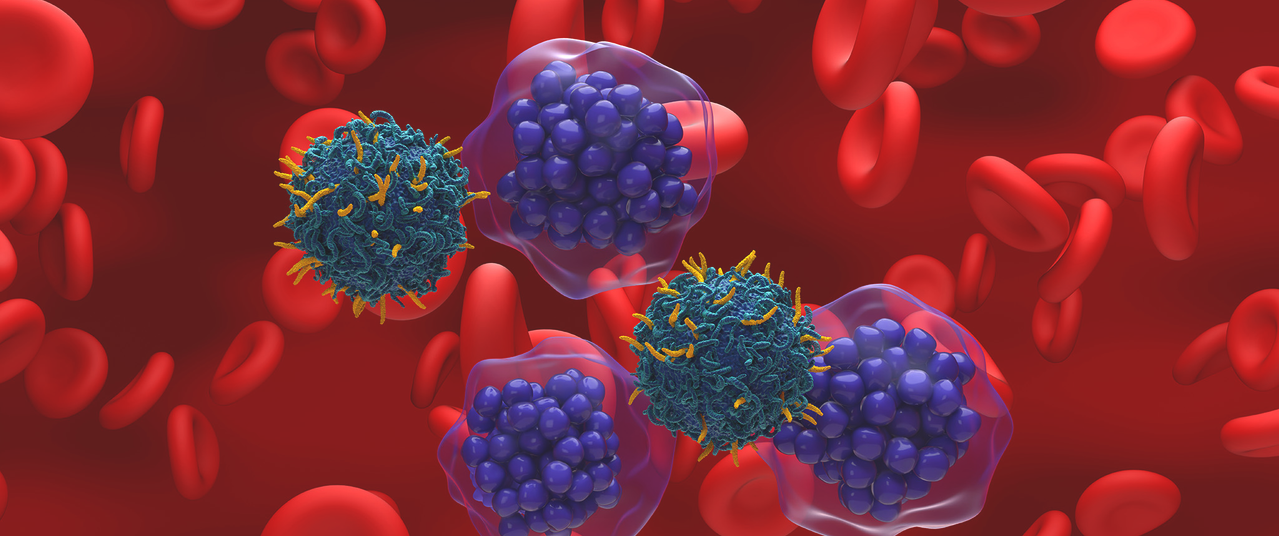 Advancements in Lymphoma Treatment Highlighted by Expert
